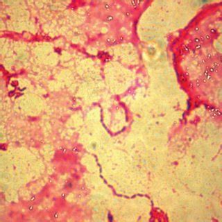 Comparison Of Genome Maps Of Bordetella Pertussis And Bordetella