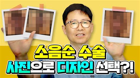 소음순수술 필요한 상태와 성형 후 모양 선택방법은 YouTube