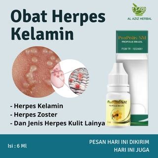 Jual Obat Herpes Kelamin Pria Dan Wanita Bintik Bintik Di Kelamin