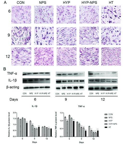 Hyp Nps Can Down Regulate Il 1β And Tnf α Expression Levels A Ihc