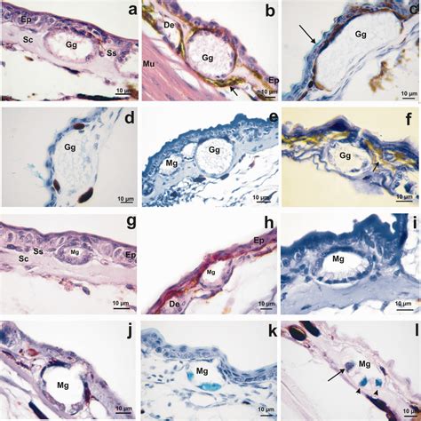 Morphological Changes in Skin Glands During Development in Rhinella Arenarum (Anura: Bufonidae ...