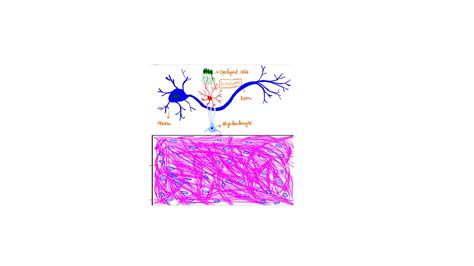 Pathology of Astrocytoma - Pathology Made Simple