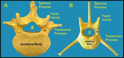 Comparative Image Of Human Lumbar Vertebrae A And Canine Lumbar