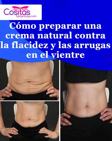 Lista Foto Aparatos Para Eliminar Celulitis Y Flacidez Alta