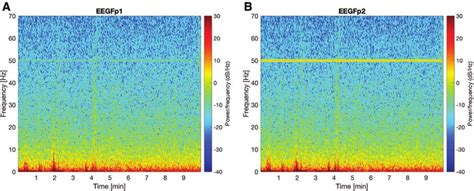 A And B Density Spectral Array As Obtained From The Fp Electrodes Of