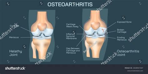 The Human Knee Anatomy Vector Illustration Royalty Free Stock Vector