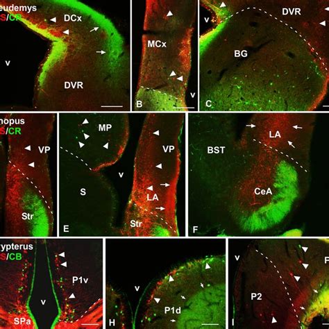 Photomicrographs Of Transverse Sections Through The Telencephalon Of