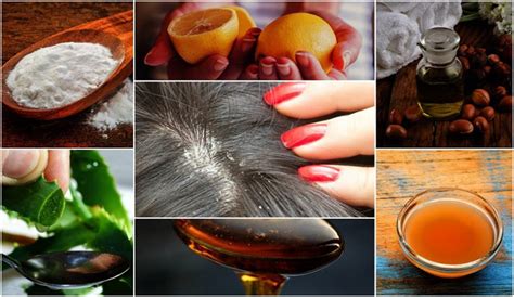 10 Effective Home Remedies for Dandruff | Best Herbal Health