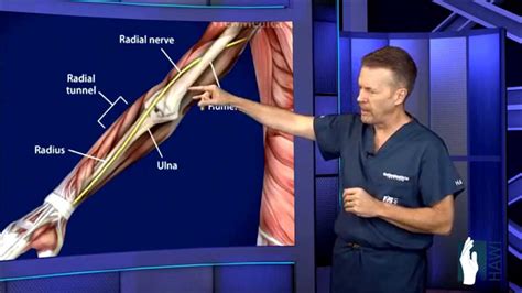 Radial Tunnel Surgery - YouTube