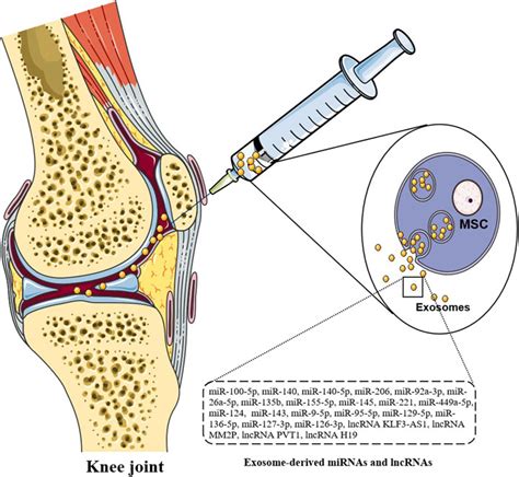 Frontiers The Research Progress Of Exosomes In Osteoarthritis With