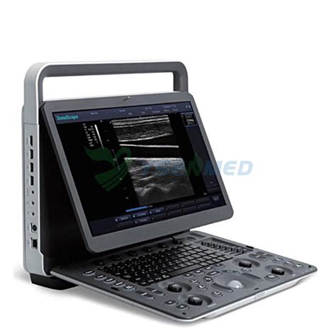 Sonoscape E Portable Colour Doppler Ultrasound Machine Sonoscape