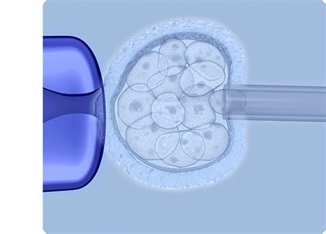 Preimplantation Genetic Testing Pgt Perfect Fertility Center