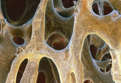 Spongy Bone Tissue Stock Image P Science Photo Library