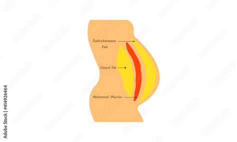 Fat Body Diagram Human Belly And Abdomen Fat Layer Vector Location Of