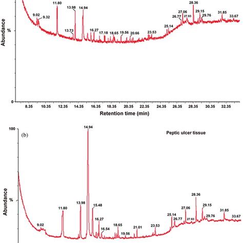 Typical Gcms Total Ion Current Tic Chromatograms A Chromatogram Porn Sex Picture