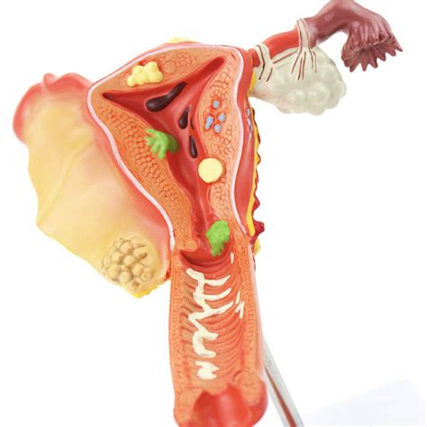 Buy Xyxz Anatomy Models Anatomical Human Uterus Model Medical