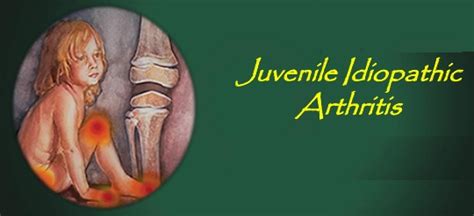 Juvenile Arthritis