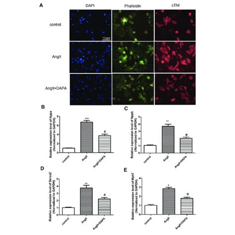 Dapagliflozin Mediated The Plin Ppar Signaling Axis To Attenuate