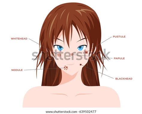 Face Acne Without Acne Vector Stock Vector Royalty Free 639502477