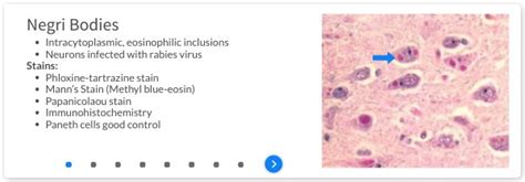 69506 - Stains for brains and nervous tissue