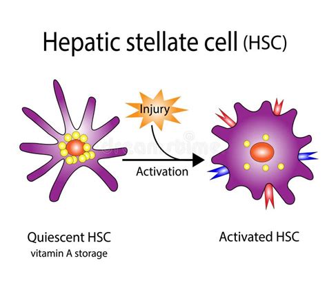 Fibrose Hepática Hepática De Células Esteladas Hepáticas Hsc