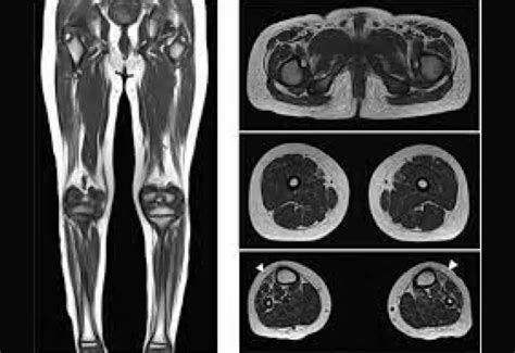 How Much Does A Low Extremity Non Joint Mri Cost Cura4u