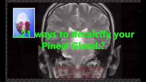 21 Ways To Decalcify Your Pineal Gland One News Page Video