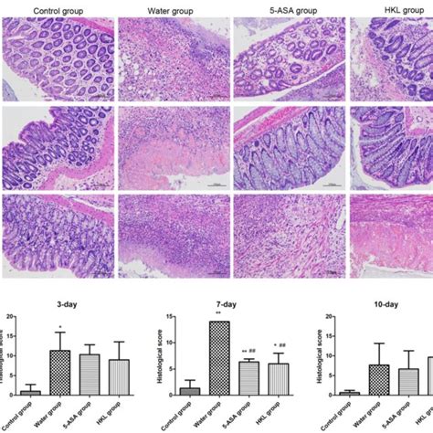 Histological Grading Of Colitis A Representative Photographs Showing