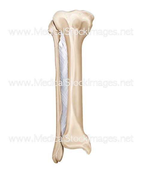 Tibia and Fibula Bones with Interosseous Membrane – Medical Stock ...