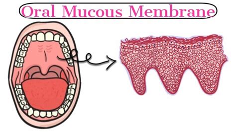 Oral Mucous Membrane Focus Dentistry