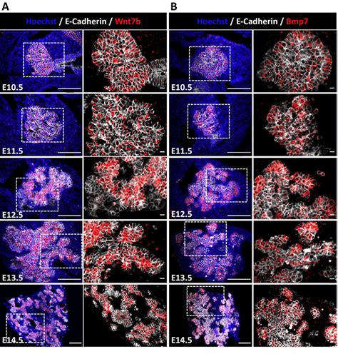 Localization Of Wnt7b And Bmp7 Expressing Cells In Developing Pancreas