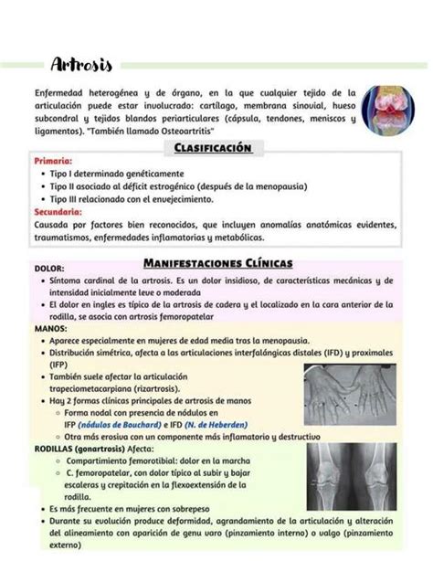 Reumatología Ana Francisco uDocz