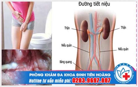 Tiểu buốt nữ giới là bệnh gì 2 nguyên nhân và cảnh báo nguy hiểm