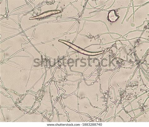 Microscopic Morphology Trichophyton Mentagrophytes Trichophyton ...