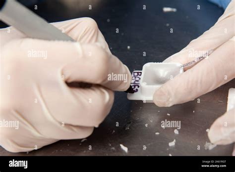 Scientist Preparing Paraffin Blocks Containing Biopsy Tissue For