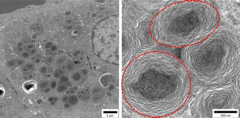 Liver Centrilobular Hepatocyte Showing Lamellar Bodies Liver Left Download Scientific