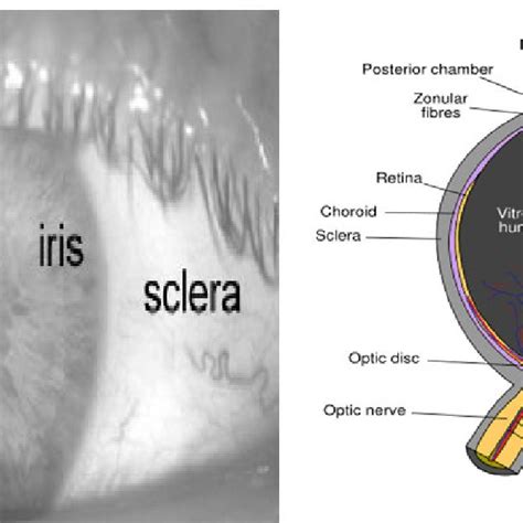 Anatomy of a frontal image of the eye (Wolf, 1976). | Download ...