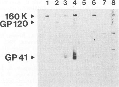 Western blot of HIV viral proteins present on a commercial HIV Western ...