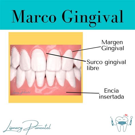 Marco Gingival Periodoncia Odontología Cosas De Enfermeria