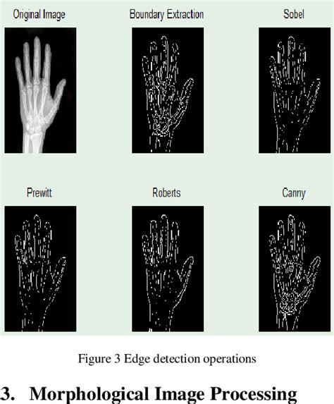 Morphological Image Processing Hot Sex Picture