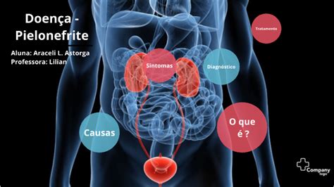 PIELONEFRITE By Araceli Astorga On Prezi