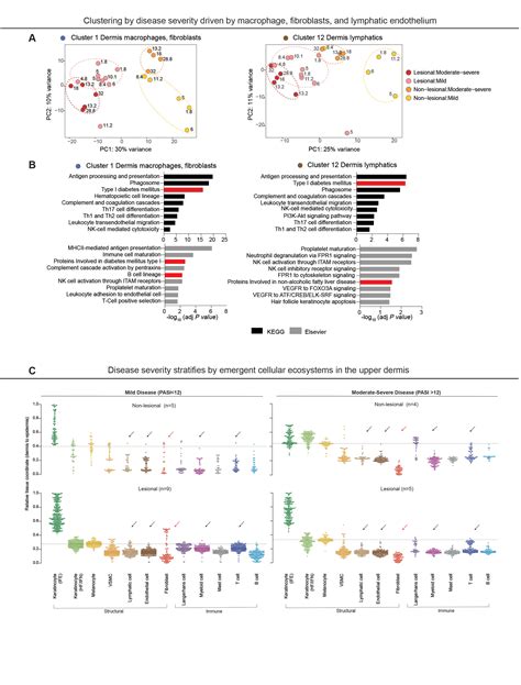 Spatial Transcriptomics Stratifies Health And Psoriatic Disease