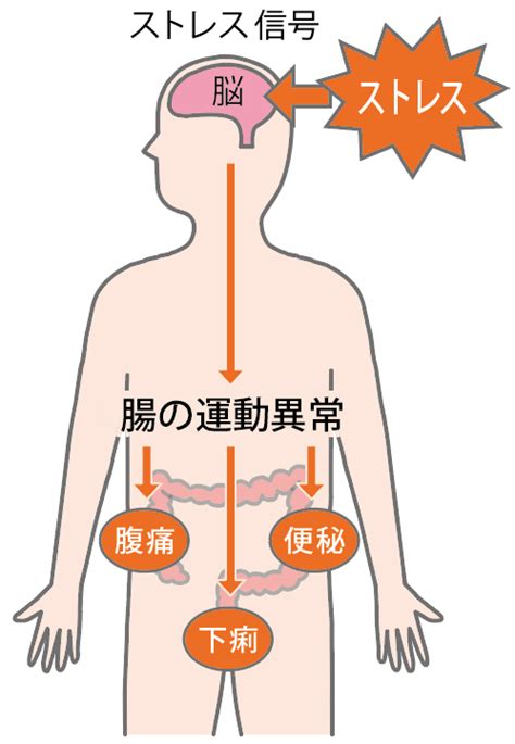 過敏性腸症候群（ibs）｜オリンパス おなかの健康ドットコム