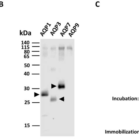 Gene Expression Analysis Of Aquaporins In Isolated Human Primary