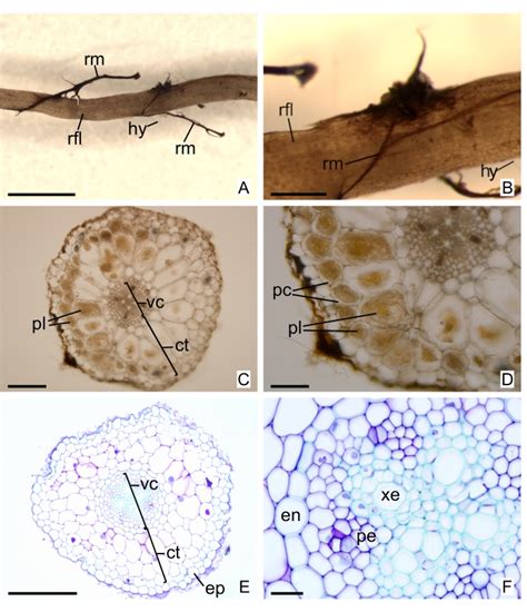 Microscopy Techniques For Interpreting Fungal Colonization In