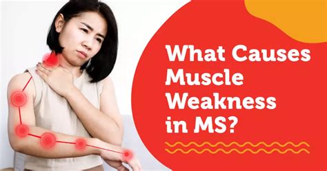 What Causes Muscle Weakness in MS? | MyMSTeam