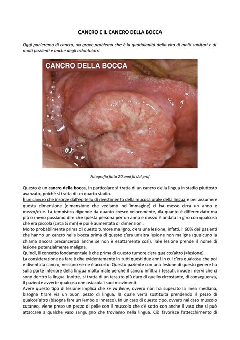 Cancro E IL Cancro Della Bocca CANCRO E IL CANCRO DELLA BOCCA Oggi