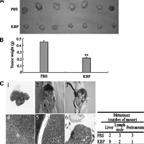 KBP Inhibits Tumor Growth And Metastasis Of Orthotopic Transplanted