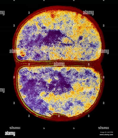 False Colour Transmission Electron Micrograph Of The Spherical