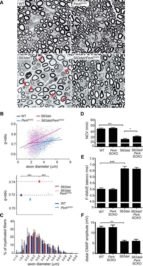 Ablation Of Perk In Schwann Cells Improves Myelination In The S63del